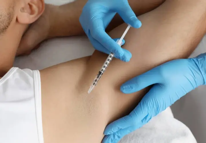 En person får botox mot svett i armhålan. En spruta injicerar vätska under huden.