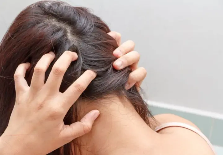 Persona se rasca la cabeza, indicando un problema de higiene del cabello.