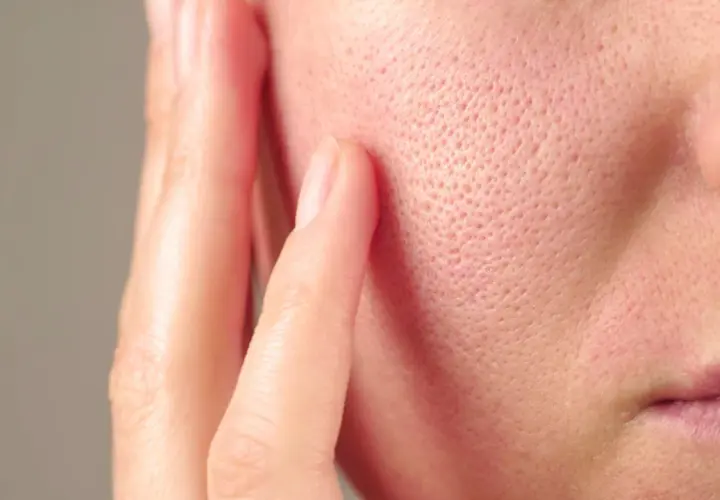 Gros plan sur la joue d'une personne, montrant les pores de la peau et un doigt effleurant délicatement la surface.