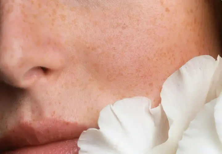 Piel con pecas y un pétalo blanco. Las ceramidas para que sirve: restauran la barrera cutánea, hidratan y protegen.