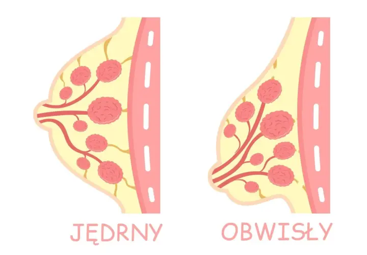 Ilustracja porównuje jędrne i obwisłe piersi, pokazując różnice w ich strukturze.