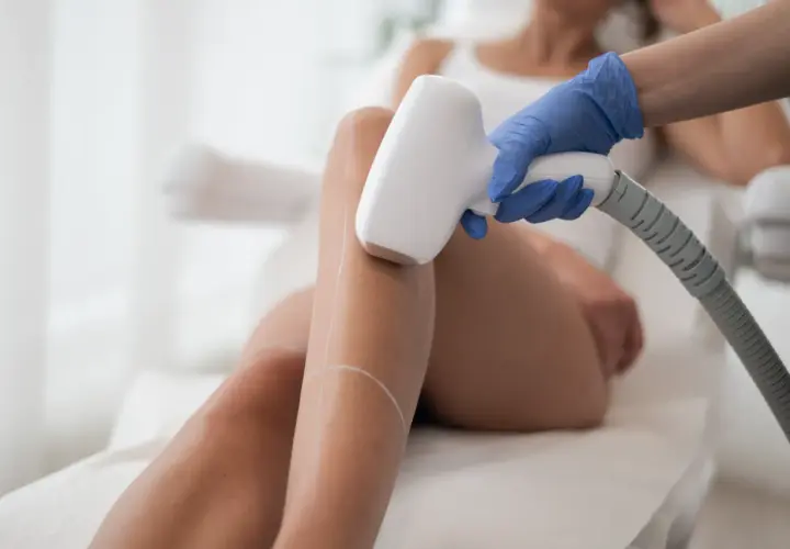 Depilacja laserowa: Gładka skóra na lata? Sprawdź, jak długo!