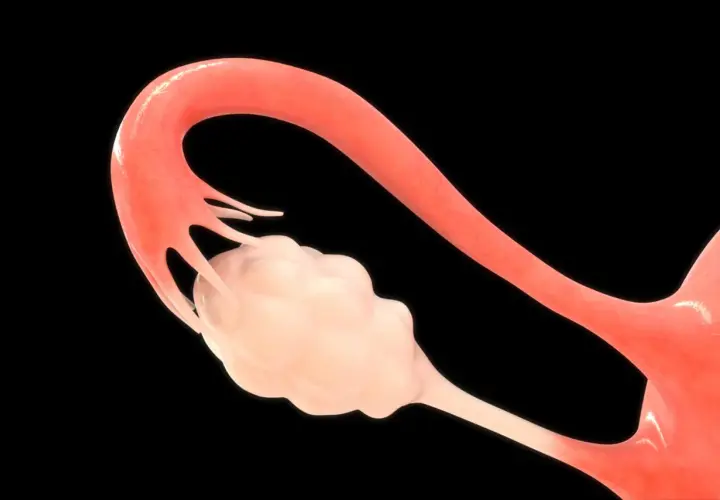 Anatomia kobieca: jajniki i jajowód. Jasnoróżowy jajnik otoczony strzępkami jajowodu.