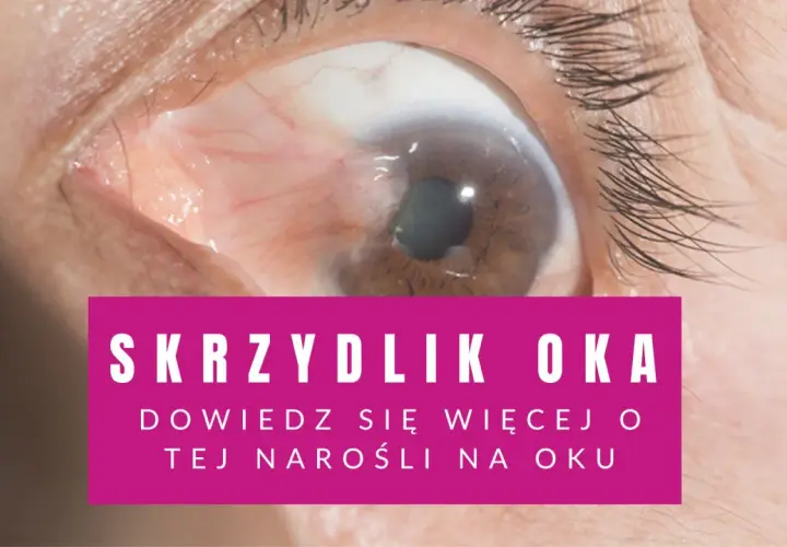 Zbliżenie na oko z widocznym skrzydlikiem. Różowy pasek z tekstem "SKRZYDLIK OKA".
