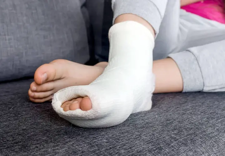 Dziecko z krzywą ręką po zdjęciu gipsu, stopa w opatrunku.