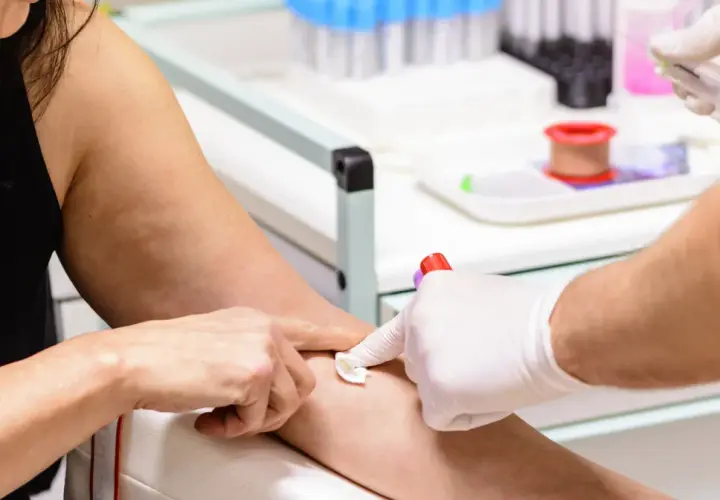 Pobieranie krwi do badań. Pacjentka ma **mpv niskie**, co może wymagać dalszej diagnostyki.