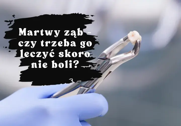 Bolący ząb? Natychmiastowa ulga i sygnały, by iść do dentysty.