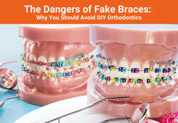 Fake braces: Jak zrobić i dlaczego to zły pomysł?