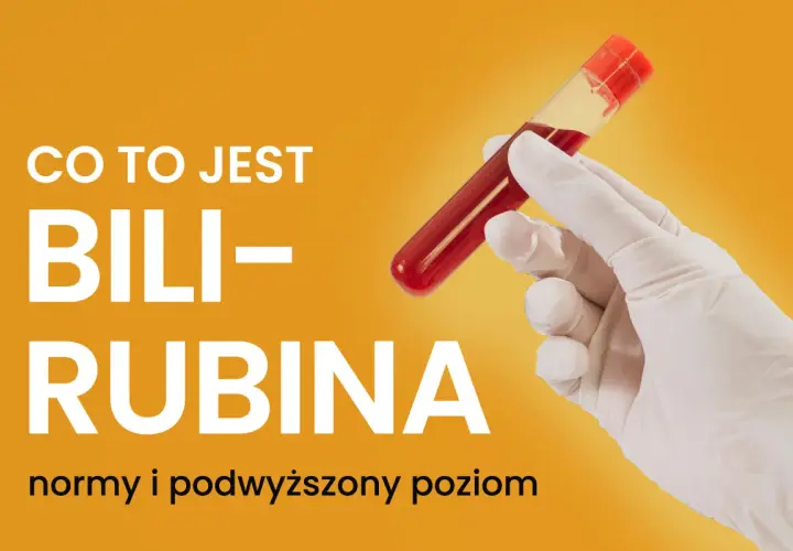 Co to jest bilirubina? Normy i podwyższony poziom. Ręka w rękawiczce trzyma probówkę z krwią.