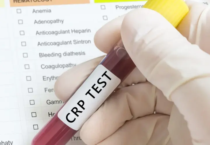 Ręka w rękawiczce trzyma probówkę z krwią do badania CRP TEST. Na tle widoczna lista badań, m.in. białko c reaktywne.