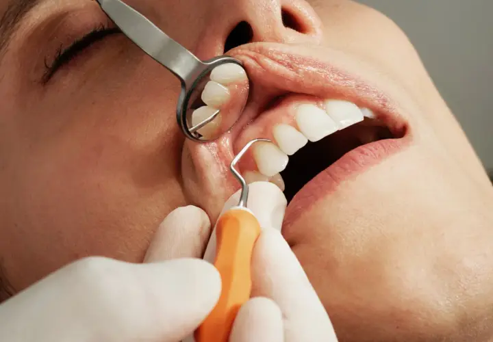 Dentysta wykonuje skaling ultradźwiękowy, używając narzędzi do oczyszczania zębów.