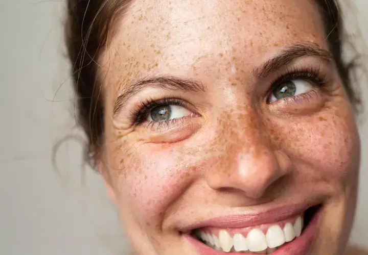 Lachendes Gesicht einer Frau mit Sommersprossen, die den natürlichen Pigment-Haut-Look unterstreichen.