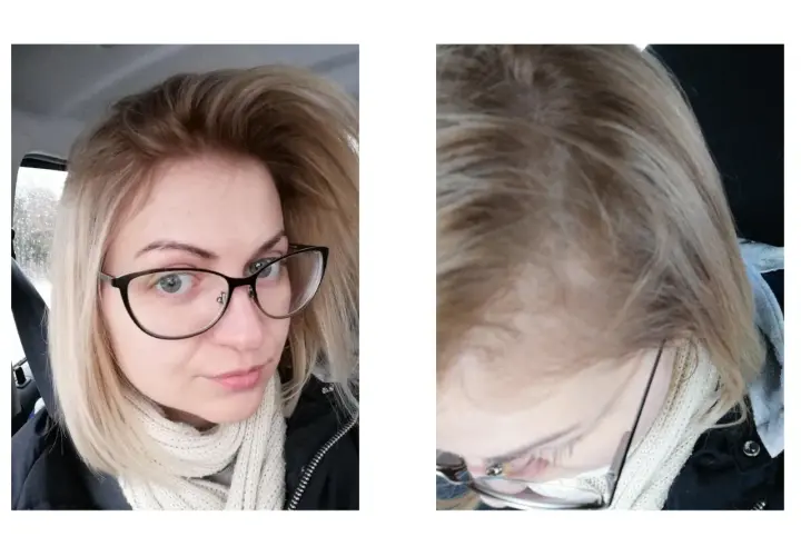 Farba do włosów nie chwyta? Oto dlaczego i jak to naprawić!