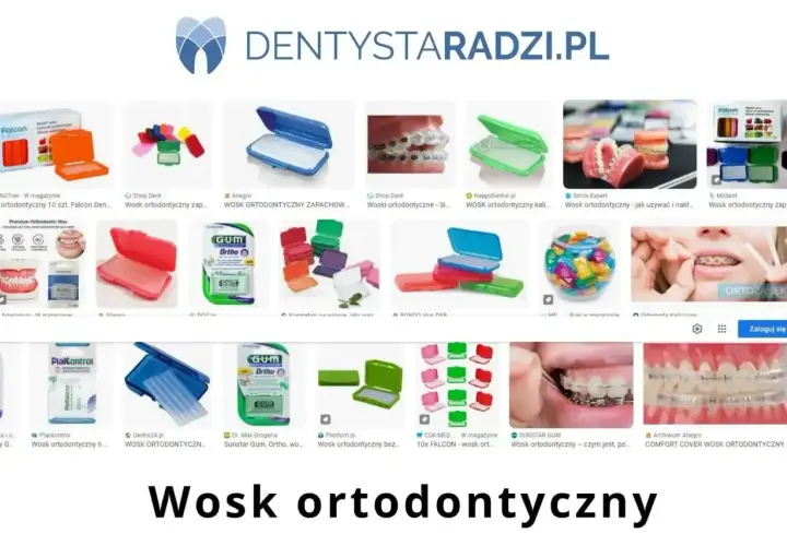Woski ortodontyczne w różnych opakowaniach, idealne, gdy odklejony zamek w aparacie sprawia dyskomfort.