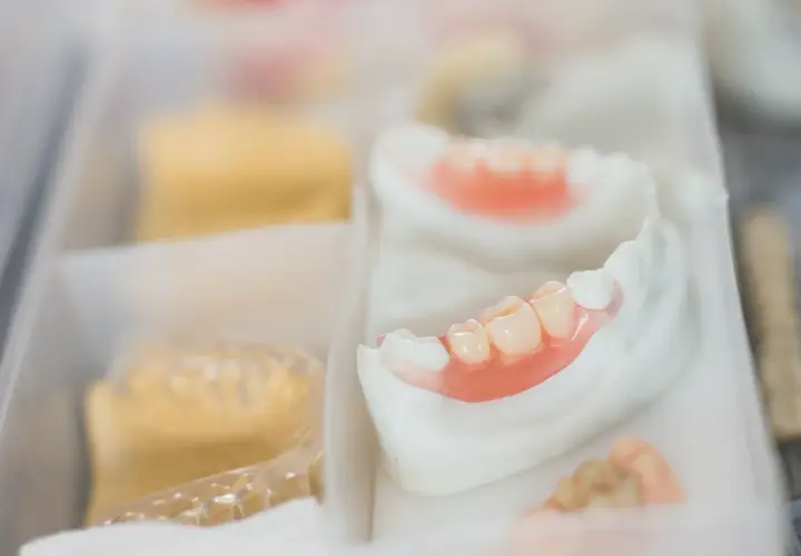Protesi mobile inferiore in fase di lavorazione. Si osservano i denti artificiali e la base rosa, pronti per risolvere i problemi di masticazione.