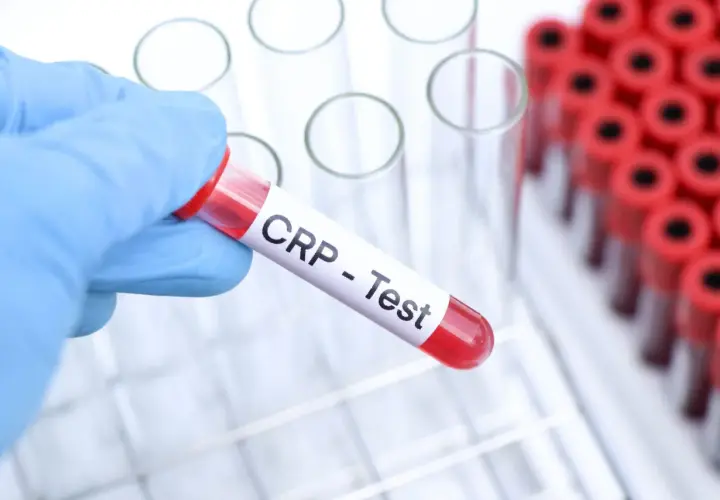 Ręka w niebieskiej rękawiczce trzyma probówkę z napisem "CRP - Test". W tle widać stojak z innymi probówkami. Cena badania CRP jest kluczowa dla oceny stanu zapalnego.