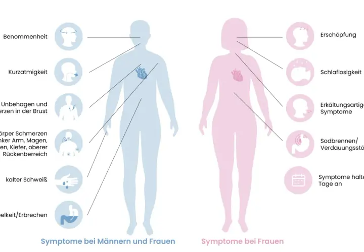 Männer: Benommenheit, Kurzatmigkeit, Brustschmerz, Oberkörperschmerzen, kalter Schweiß, Übelkeit. Symptome Herzinfarkt Männer erkennen.