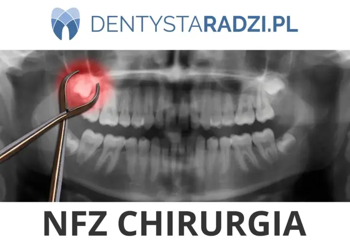 Rentgen zęba z kleszczami i zaznaczonym bólem. Napis NFZ CHIRURGIA.