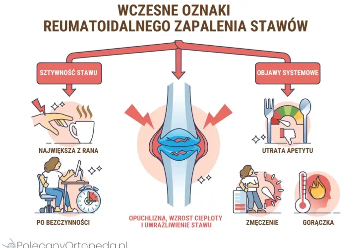 Wczesne objawy wirusowego zapalenia stawów: sztywność, opuchlizna, utrata apetytu, zmęczenie, gorączka.