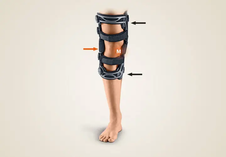 Ein Bein mit einer valgisierenden Orthese, die das Knie stabilisiert. Pfeile zeigen auf die Gelenke der Orthese.