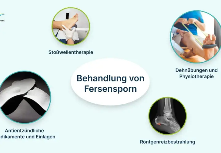 Behandlung von Fersensporn: Stoßwellentherapie, Dehnübungen, Medikamente, Einlagen und Röntgenreizbestrahlung.