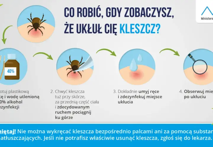 Jak usunąć kleszcza u człowieka? Bezpieczny poradnik krok po kroku