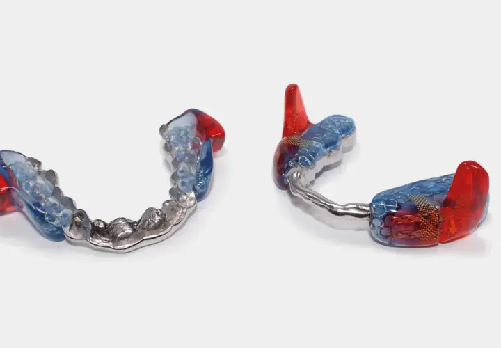 Dos aparatos mandibulares transparentes con detalles en rojo y azul, uno con una banda metálica.