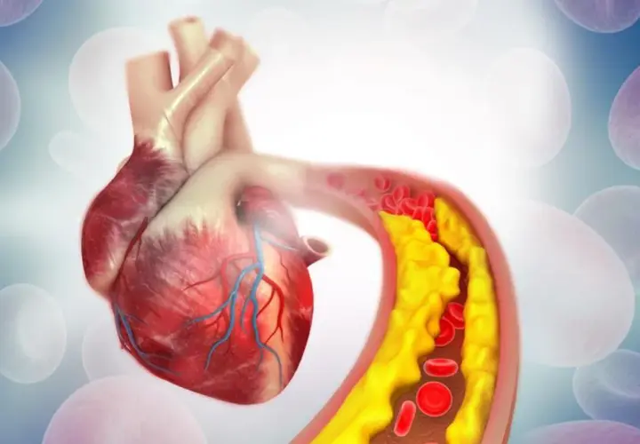 Twój cholesterol: Jak zbadać, zrozumieć wyniki i chronić serce?