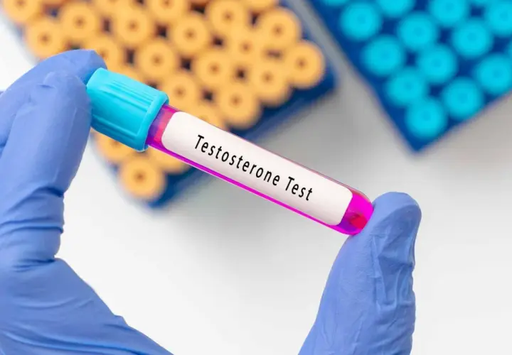 Testosteron bez recepty w jakim kraju? Sprawdź, gdzie jest dostępny