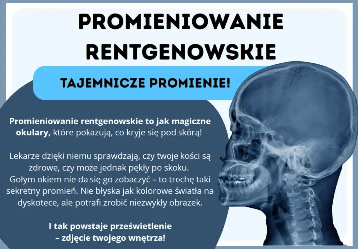 Promieniowanie rentgenowskie to magiczne okulary, które pokazują kości. Tajemnicze promienie tworzą niezwykłe prześwietlenia wnętrza.