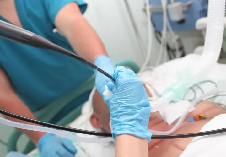 Lekarz w niebieskich rękawiczkach wykonuje bronchoskopię, wprowadzając endoskop do dróg oddechowych pacjenta podłączonego do respiratora.