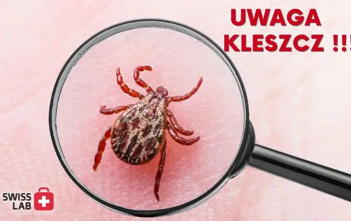 Kleszcz sam odpadnie? Poznaj ryzyko i usuń go bezpiecznie!