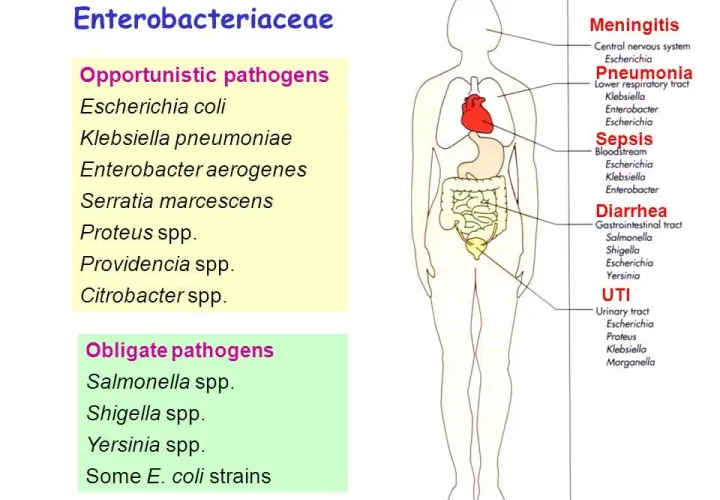 Bacterium lactis aerogenes: 5 kluczowych faktów dla zdrowia