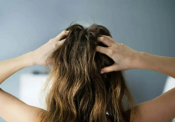 Person kliar sig i håret, upplever problem med fett hår och torr hårbotten.