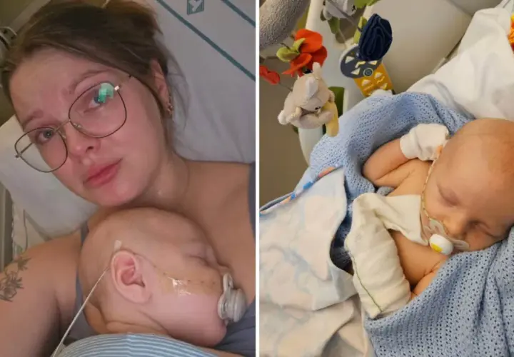 En mamma håller sitt sovande barn. Barnet har en sond och en napp. Det är en tuff tid, men bebis spyr mycket och behöver extra omvårdnad.