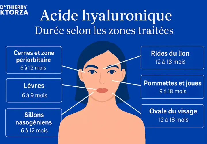 Infographie sur la durée des effets de l'acide hyaluronique selon les zones traitées : cernes, lèvres, rides, pommettes, ovale du visage. Un bienfait pour la peau.