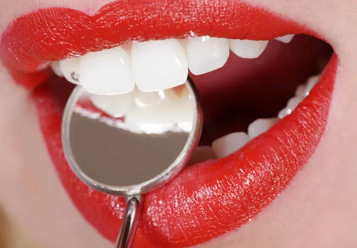 Labios rojos brillantes y dientes blancos examinados con un espejo dental. Averiguar cuanto se tarda en hacer un empaste pequeño es rápido.