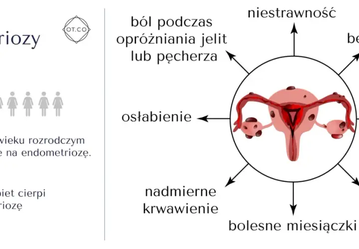 Ilustracja przedstawia objawy endometriozy: ból, niestrawność, bezpłodność, mdłości, bolesny stosunek, bolesne miesiączki, nadmierne krwawienie i osłabienie.
