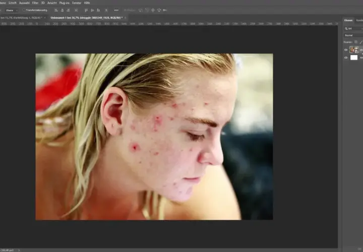 Młoda kobieta z trądzikiem na twarzy, edytowana w Photoshopie. Widoczny panel warstw i narzędzie pędzel photoshop.