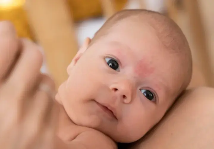 Primo piano di un neonato con pelle screpolata, tenuto in braccio.