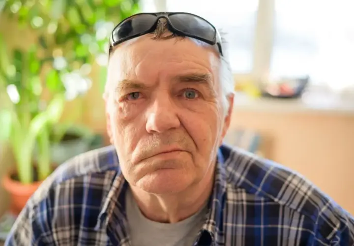 Mężczyzna z widocznym porażeniem nerwu twarzowego, opuszczony kącik ust po prawej stronie.