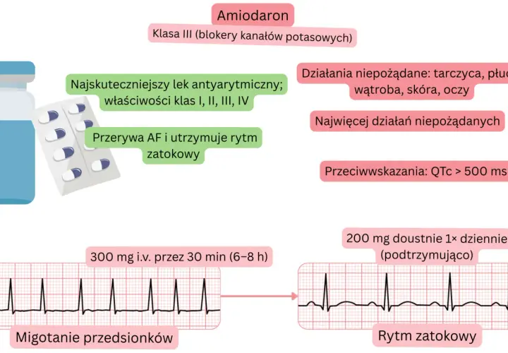 Amiodaron, lek antyarytmiczny, przerywa migotanie przedsionków, przywracając rytm zatokowy. Opakowanie leku i EKG.