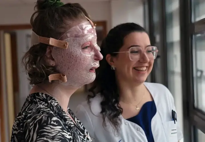 Une femme porte un masque transparent sur le visage, peut-être pour aider à comment cacher une brûlure. Une autre femme, souriante, la regarde.
