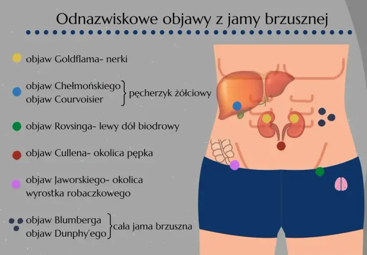 Objaw Chełmońskiego, wskazujący na pęcherzyk żółciowy, zaznaczony niebieską kropką na ilustracji jamy brzusznej.