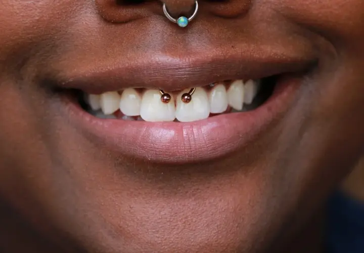 Uśmiechnięte usta z widocznym smiley piercingiem między zębami.