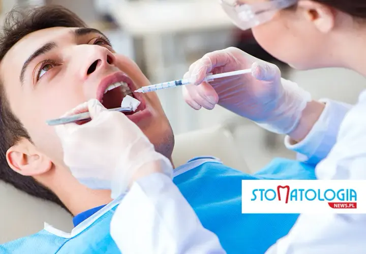 Znieczulenie u dentysty: bez bólu i strachu? Przewodnik eksperta