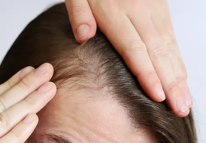 Manos revisando el cuero cabelludo y el cabello fino. Consejos para como cuidar tu pelo y mantenerlo fuerte.