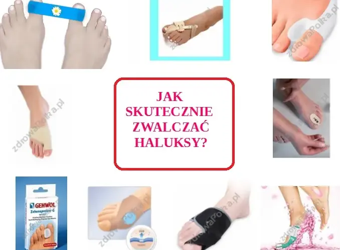 Skuteczna profilaktyka haluksów: Twój przewodnik do zdrowych stóp