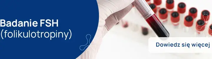 Kiedy badać FSH? Kluczowe informacje dla zdrowia hormonalnego
