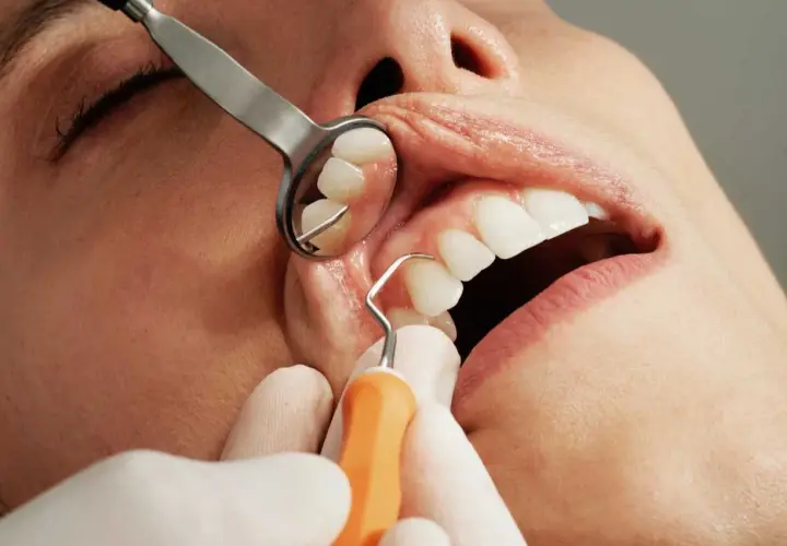Esame dentale ravvicinato: uno specchietto riflette i denti mentre uno strumento dentistico esamina un dente, evidenziando una potenziale infezione dentale trascurata.